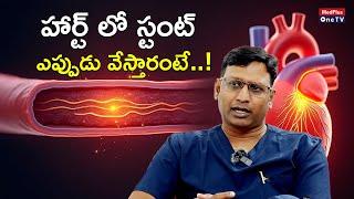 Reasons Why Stent is Mandatory l Dr. Praneeth Polamuri @MedPlusONETV