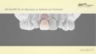 BioHPP SKY elegance - individuelle Crown-Abutments Workflow (German)