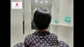 Hair Toppers for Women  in Chennai - Wig-O-Mania UK Hair Brand