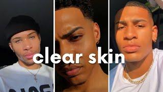 how to get clear skin for guys asap