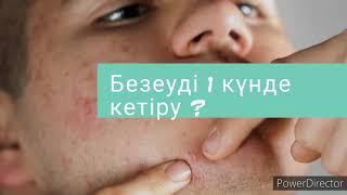 Безеуді қалай кетіреміз? 01.04.2021жыл