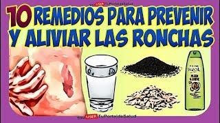 10 Remedios para Aliviar las Ronchas | Tratamientos para la Urticaria Ronchas Picazon de Piel