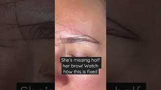 She has a scar and is missing left her brow! Watch how this is fixed with microblading & shading.