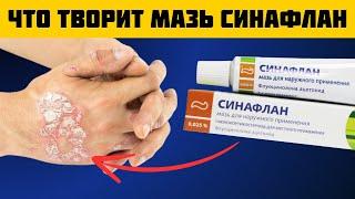 СИНАФЛАН! Вы ТОЛЬКО посмотрите на что способна эта мазь! Что Творит Синафлан?!