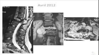 Séance d'interpretation Radiologie