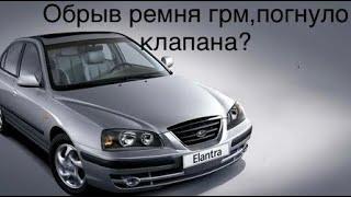 Хёндай Элантра 2005 года 1,6 16 клапанник ремонт гбц после обрыва ремня грм.