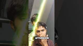 Day 4 of 15 days challenge  || Real transformation #lookmaxxing #skincare #skincareroutine