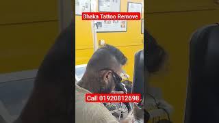 Dhaka Tattoo Remove / Bangladesh Tattoo Remove / Tattoo Remove BD