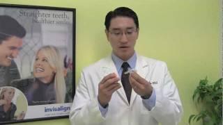 Invisalign by Glenview Dentist 60025 Dr. Eric Lim