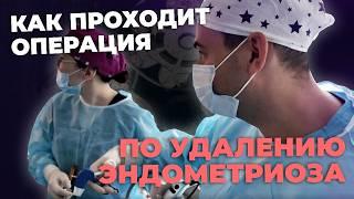 Как лечить эндометриоз | Лечение эндометриоза операция | История пациентки