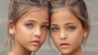 Wait Until You See the Most Beautiful Twins in the World Now