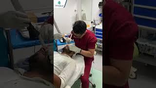 Painless Mole Removal | Best Mole removal in Delhi | Laser mole removal | SkinQure