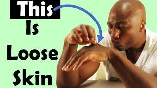 Loose Skin vs Fat. HINT: It's Not Loose Skin