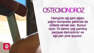 #Osteoxondroz nədir? Və təbii müalicə üsulları