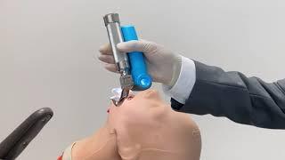 How to Avoid Dental Injuries During Intubation