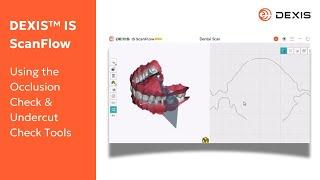 DEXIS™ IS ScanFlow - Using the Occlusion Check & Undercut Check Tools