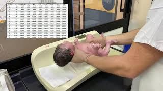 Antropometría del recién nacido -  Escuela de Obstetricia