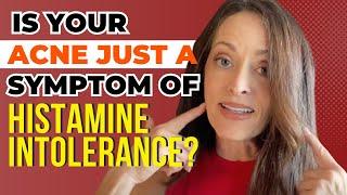 Why Gut Health is So Important With Acne | Acne Histamine Connection