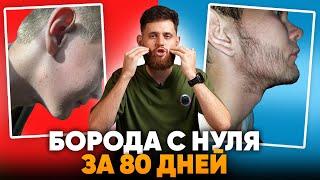 Запустил рост бороды и отрастил за 80 дней / Результаты Mr.Volos