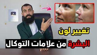 علامات خطيرة يسببها لك السحر المأكول أو التوكال