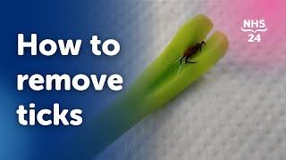 How to remove a tick