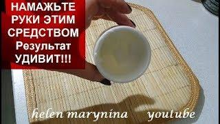 ЭТО ШОК!!!НАМАЖЬТЕ РУКИ ЭТИМ СРЕДСТВОМ Результат УДИВИТ!!!helen marynina