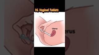 Tips on choosing the right tablets for your needs! Types of tablets #viral #shorts