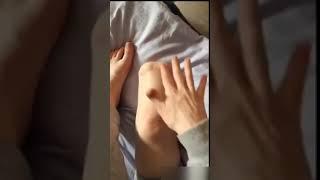 A Knee Amputee shows prosthetic leg and gets ready to fit it | Very Inspirational and Motivating