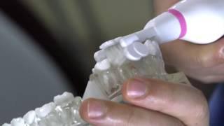 Triple Bristle 3D sonic toothbrush demonstration on dental model