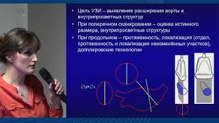 Ультразвуковое исследование в диагностике аневризмы брюшного отдела аорты, Саратова А.К.