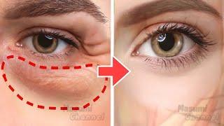 Anti-Aging Face Exercises For Eye Bags, Dark Circles Under Eyes, Eye Wrinkles | No Surgery!