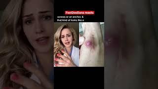 #Doctor reacts: HUGE foot lump