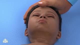 Esophageal Dilation for children with Esophageal Atresia