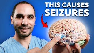 Neurologist Explains How Epilepsy ACTUALLY Works