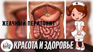 Желчный перитонит