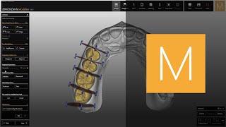 The Disccutter function in Zirkonzahn.Modellier | Zirkonzahn.Software