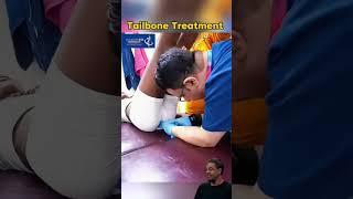 Bone treatment #viralvideo #ytshorts #comedy #treatment #trending