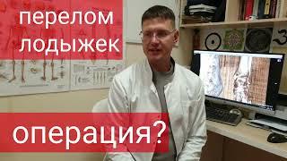 Перелом лодыжек со смещением, нужна ли операция? Как лечить без смещения, когда нагружать