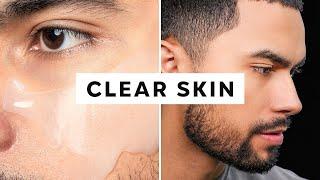 How To Get Clear Skin (Only 3 Steps)