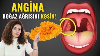 Boğaz Ağrısını 5 DƏQİQƏYƏ KƏSİR! - Təbii Müalicə Yolu Budur