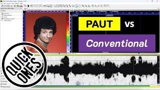 Sizing with PAUT vs Conventional UT