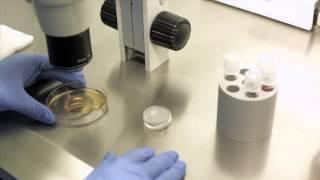 IVF - IN VITRO FERTILIZATION.