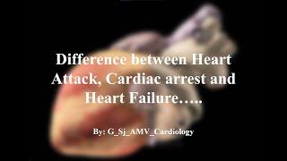 Difference in Heart attack, Cardiac Arrest and Heart Failure