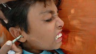 "Extreme Ear Cleaning ASMR  | Deep Mic Scratching, Sticky Wax Sounds & Ultimate Tingles!"