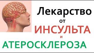 Все врачи знают!!! Оксид азота- лекарство от ИНСУЛЬТА и АТЕРОСКЛЕРОЗА