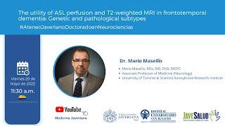 The utility of ASL perfusion and T2-weighted MRI in frontotemporal dementia