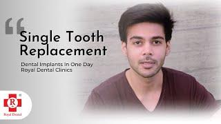 Single Teeth Implant | How A Dental Implant Is Done? Royal Dental Clinics