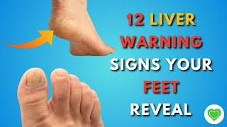 What Your Feet Tell You About Your Liver | 12 Warning Signs | Healthy Buddy