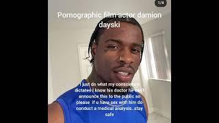 Pornographic film actor damion dayski carries the HIV virus