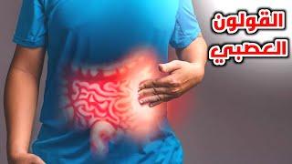 ماهو القولون العصبي؟_ What is irritable bowel syndrome